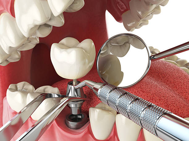 Best Emergency Tooth Extraction in Jarrell, TX